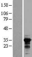 RALY Human Over-expression Lysate