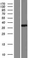 OGG1 Human Over-expression Lysate