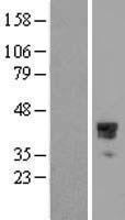 Homeo box C10 (HOXC10) Human Over-expression Lysate