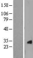 Beta crystallin S (CRYGS) Human Over-expression Lysate