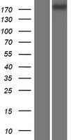 CDC42BPG Human Over-expression Lysate