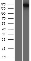 EST1A (SMG6) Human Over-expression Lysate