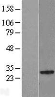 NKIRAS2 Human Over-expression Lysate