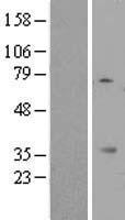 MIOX Human Over-expression Lysate