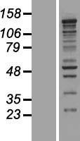 CASZ1 Human Over-expression Lysate