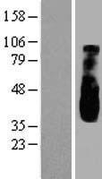 OPA1L (WBP1L) Human Over-expression Lysate