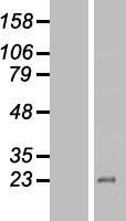 ZNF673 (KRBOX4) Human Over-expression Lysate