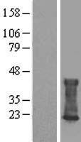 CMTM6 Human Over-expression Lysate