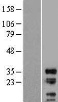 LIME (LIME1) Human Over-expression Lysate