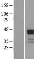 RNF126 Human Over-expression Lysate