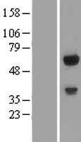 C14orf118 (GPATCH2L) Human Over-expression Lysate