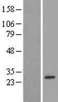 FKBP14 Human Over-expression Lysate