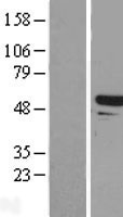 Tapasin Related Protein (TAPBPL) Human Over-expression Lysate