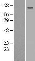 WDR11 Human Over-expression Lysate