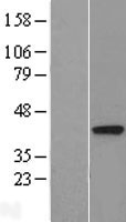 DALRD3 Human Over-expression Lysate