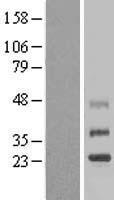 TMEM38B Human Over-expression Lysate