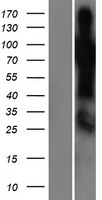 SHQ1 Human Over-expression Lysate