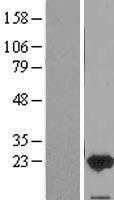 FAIM1 (FAIM) Human Over-expression Lysate