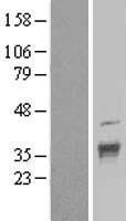 DNAJC17 Human Over-expression Lysate