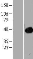 ARFGAP1 Human Over-expression Lysate