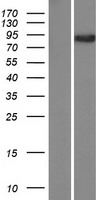 DNAI7 Human Over-expression Lysate