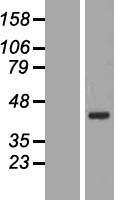 BXDC2 (BRIX1) Human Over-expression Lysate