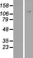 WDR52 (CFAP44) Human Over-expression Lysate
