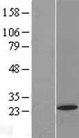 AP5S1 Human Over-expression Lysate