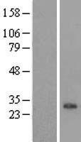COPRS Human Over-expression Lysate