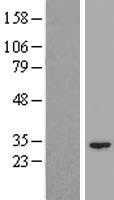 NIPSNAP3B Human Over-expression Lysate
