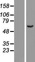 ARHGAP15 Human Over-expression Lysate