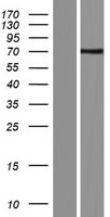 NSMase2 (SMPD3) Human Over-expression Lysate