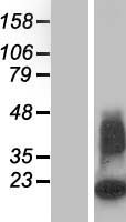 beta Defensin 3 (DEFB103B) Human Over-expression Lysate