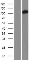 DHTKD1 Human Over-expression Lysate