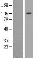 Sulfatase 2 (SULF2) Human Over-expression Lysate