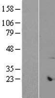 ARMCX6 Human Over-expression Lysate