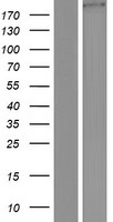 SKT (KIAA1217) Human Over-expression Lysate