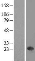NKIRAS1 Human Over-expression Lysate