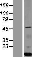 PIST (GOPC) Human Over-expression Lysate
