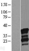 NRIP3 Human Over-expression Lysate