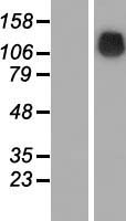 SRGAP1 Human Over-expression Lysate