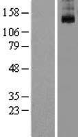 KCNT1 Human Over-expression Lysate
