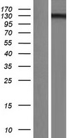 USP28 Human Over-expression Lysate