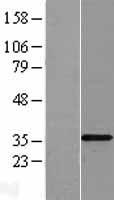 TLX3 Human Over-expression Lysate