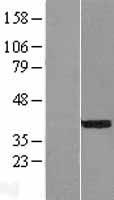 NEUROD4 Human Over-expression Lysate