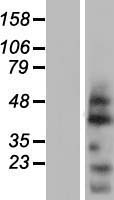OVOL2 Human Over-expression Lysate