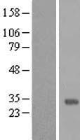 MMP26 Human Over-expression Lysate