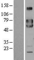 FKBP10 Human Over-expression Lysate