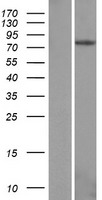 EPB41L4A Human Over-expression Lysate