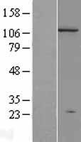 DNMT3A Human Over-expression Lysate